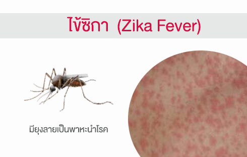 ไข้ซิกา (Zika Fever)